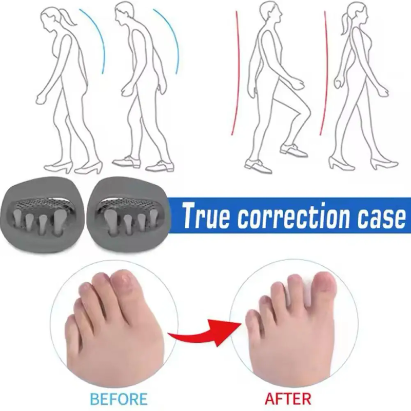 Sandal Koreksi Kaki dengan Des - Home Improvement Man ulasan dan harga